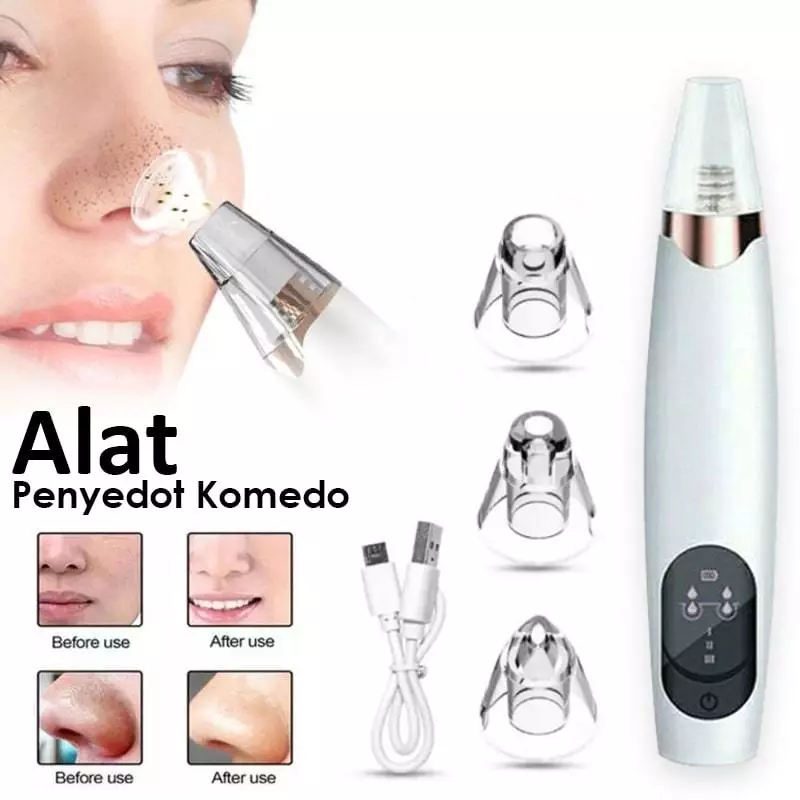 Alat Pembersih dan Penyedot Komedo / Remove Blackhead Alat Penyedot Komedo Vacum Sedot Komedo Wajah | AutoStock