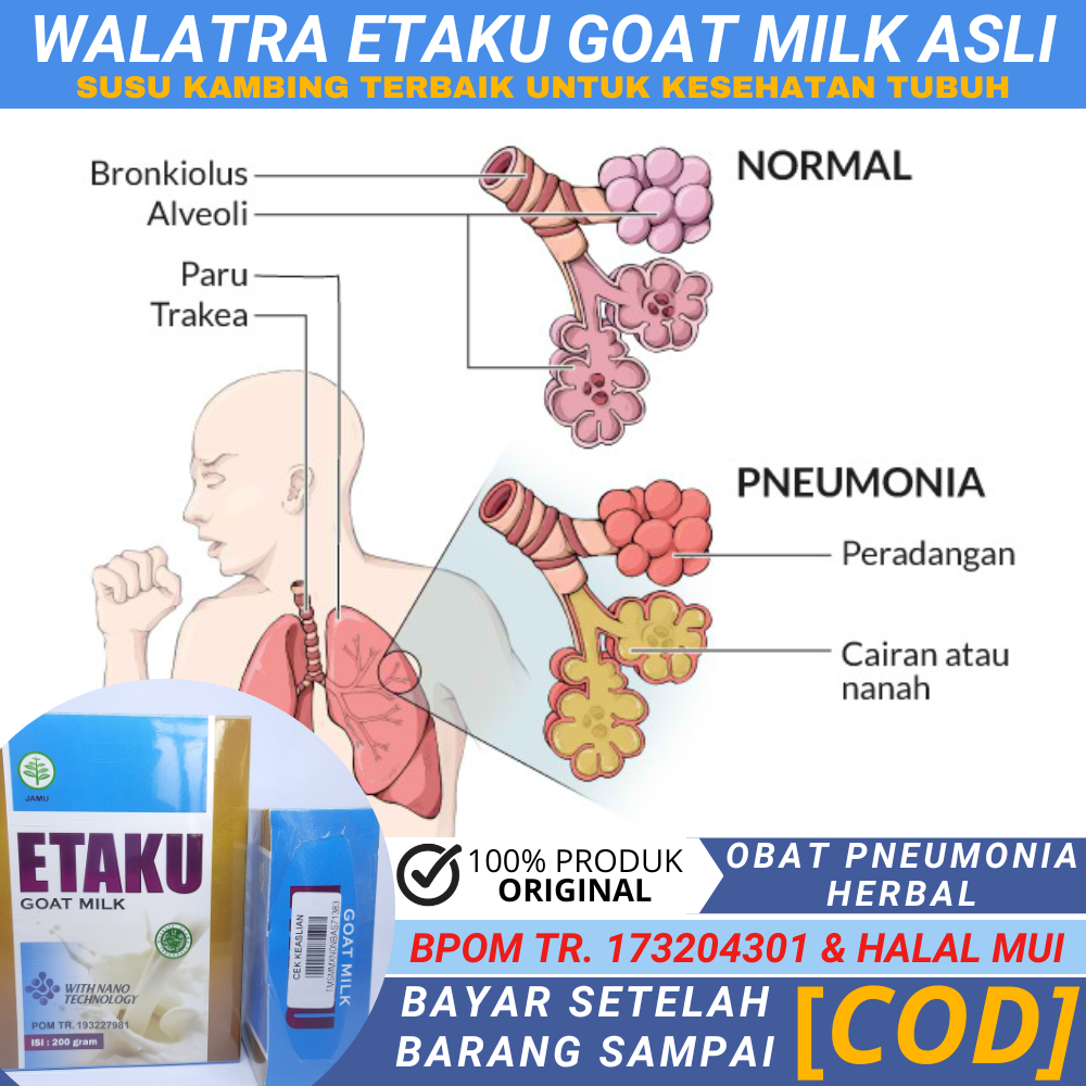 Jual Obat Pneumonia, Paruparu Basah, Paru2 TBC, Herbal Flek Paru Paru ...