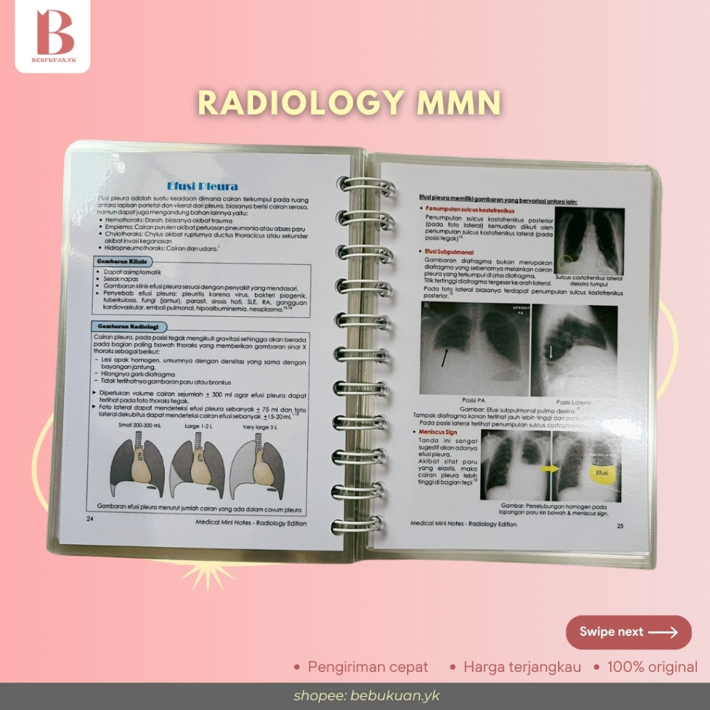 Jual Radiology Edisi 2020 Medical Mini Notes | Buku Radiologi ...