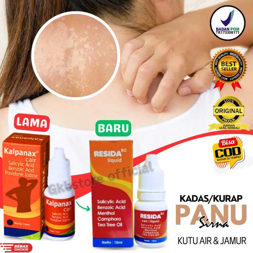 Jual Resida Cair Obat Panu Paling Ampuh 100 Salep Cream Obat Kadas