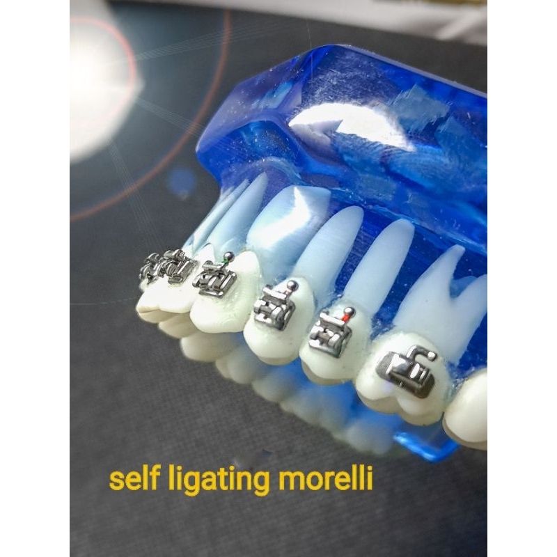 Jual Behel self ligating morelli | Bracket Self Ligating Metal Klip ...