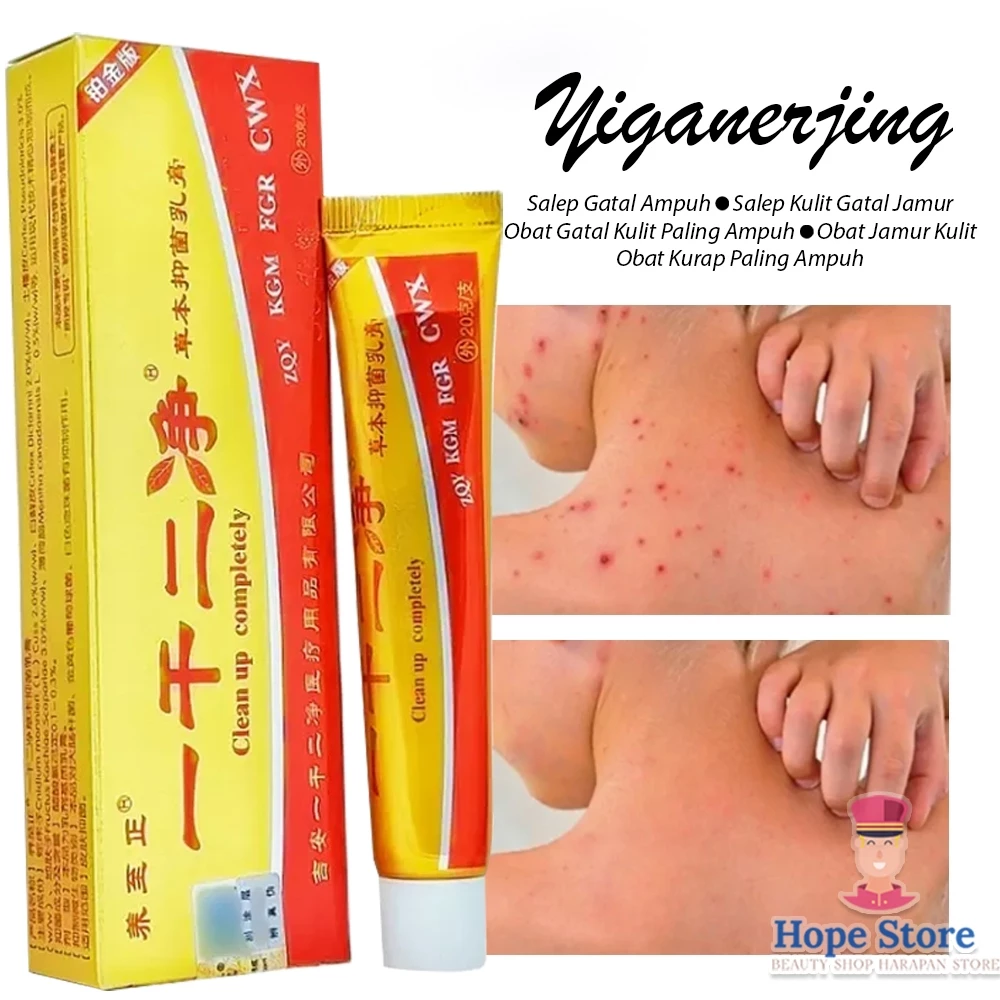Yiganerjing Obat Salep Dermatitis Eksim /Gatal Selangkangan Anti Jamur Kudis Kurap & Gigitan Serangga | AutoStock