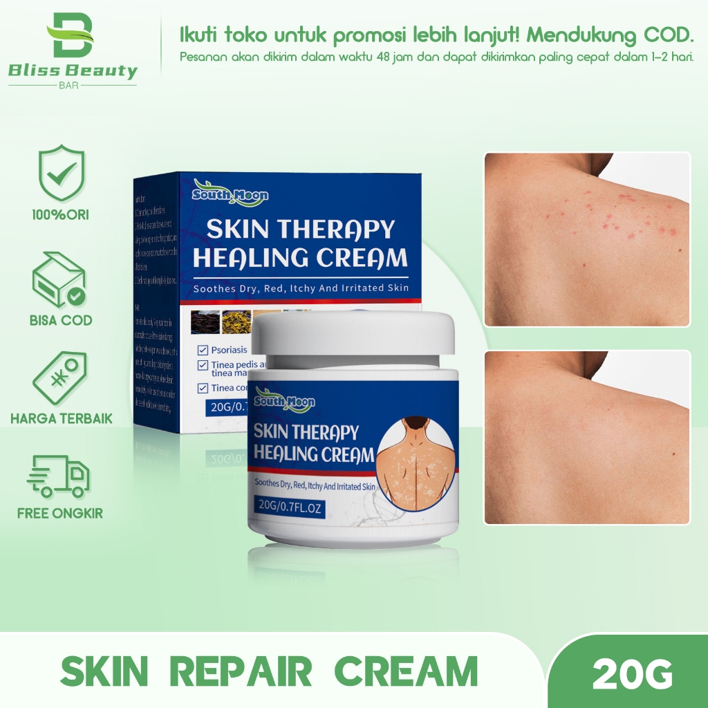 Jual South Moon Skin Terapi Healing Cream 20g Itchy Cream Skin Therapy ...