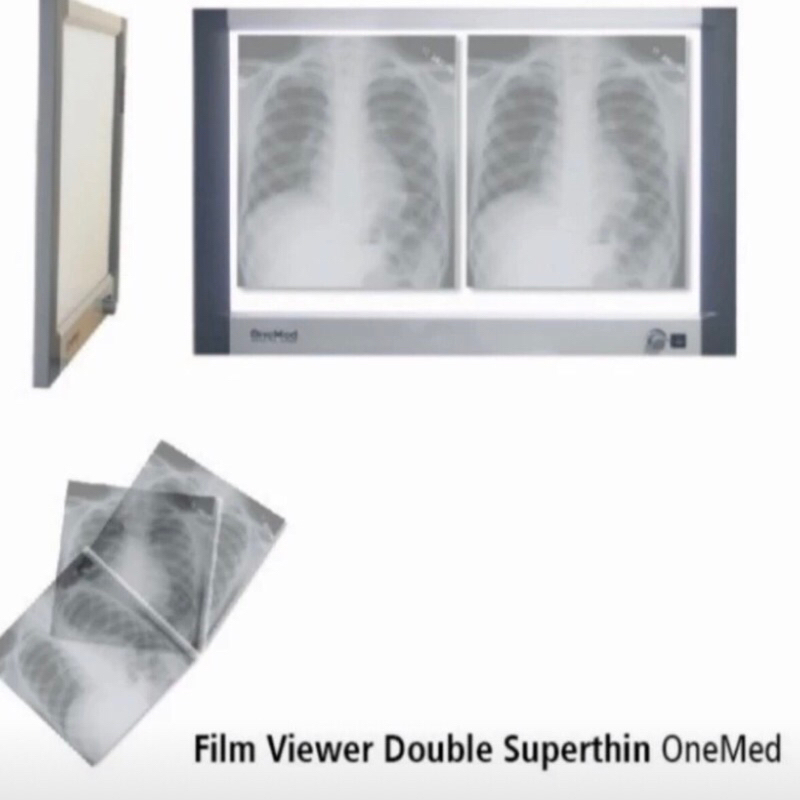 Jual Onemed Xray Flim Viewer / Flim Viewer Double superthin Onemed ...