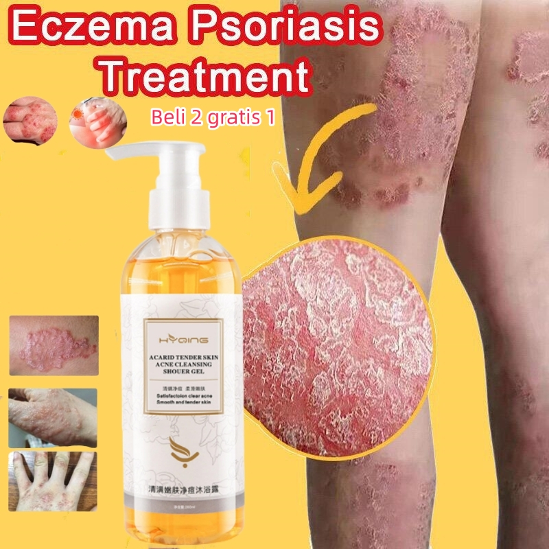 Jual eczema body wash Sabun Gatal Kulit Ampuh psoriasis Eksim Kering