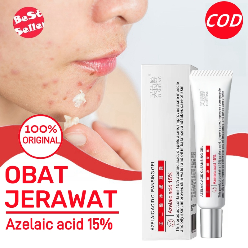 Jual 【COD & READY】Obat Penghilang Bekas Jerawat Hitam Ampuh 15g/Herbal