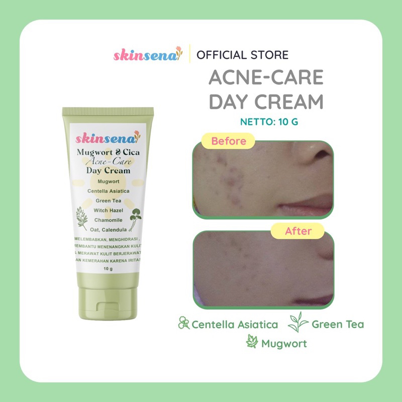 Jual Skinsena Acne Care Day Cream 10g Shopee Indonesia 3643