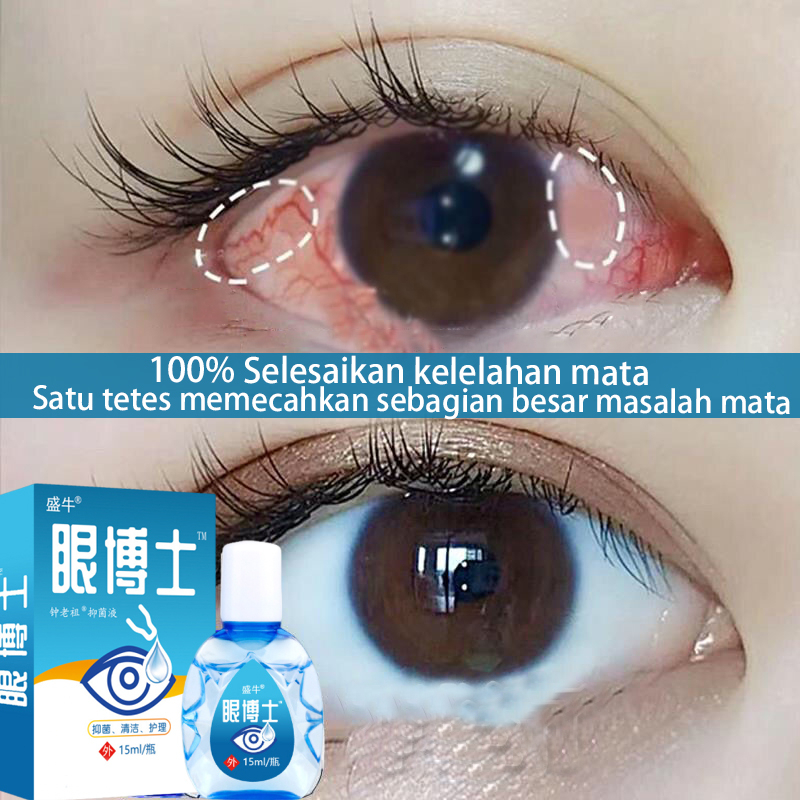 Jual Obat Mata Obat Mata Katarak Obat Tetes Mata 20ml Mata Kering Sakit Mata Darah Merah 7350