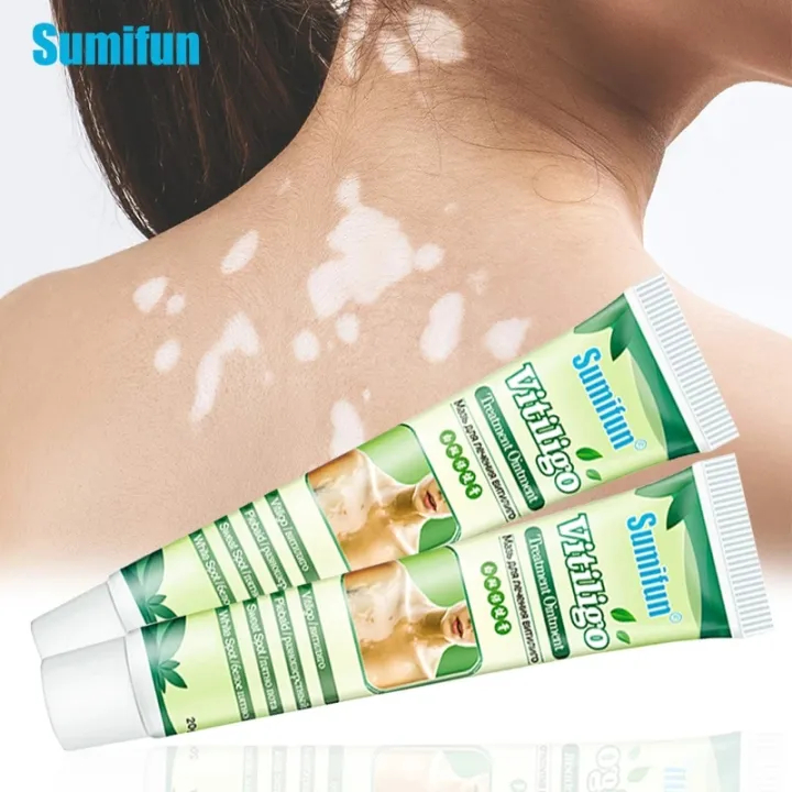Jual SUMIFUN Salep Vitiligo Cream Krim Anti Bakteri Ruam Kulit ...