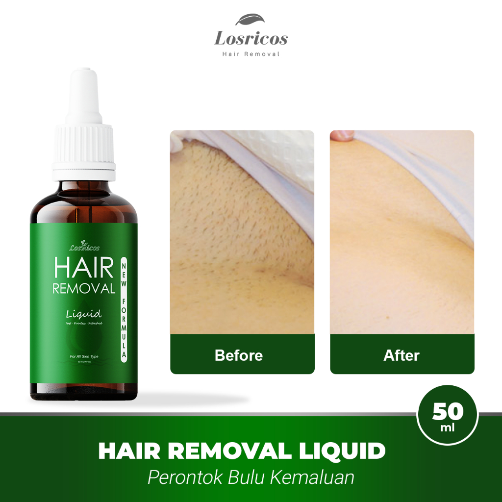 Jual Perontok Bulu Kemaluan Miss V Losricos Hair Removal Liquid Wax ...
