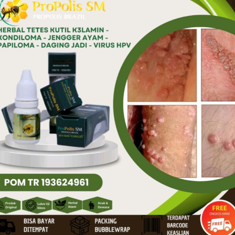 Jual PRODUK PROPOLIS MULTI KHASIAT ATASI BERBAGAI RAGAM PENYAKIT ...
