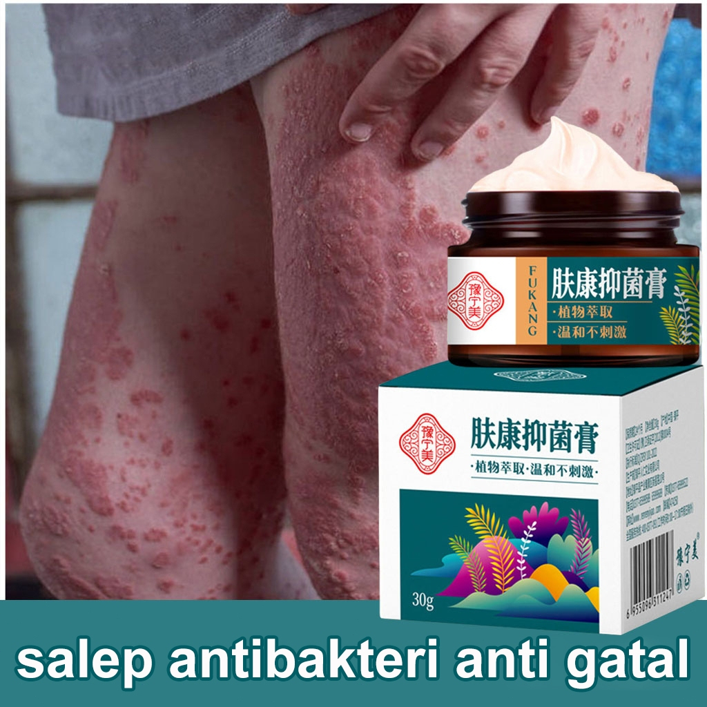 Jual Salep Gatal Paling Ampuh Obat Selangkangan Jamur Gatel Kulit Salep Obat Eksim Kulit Gatal