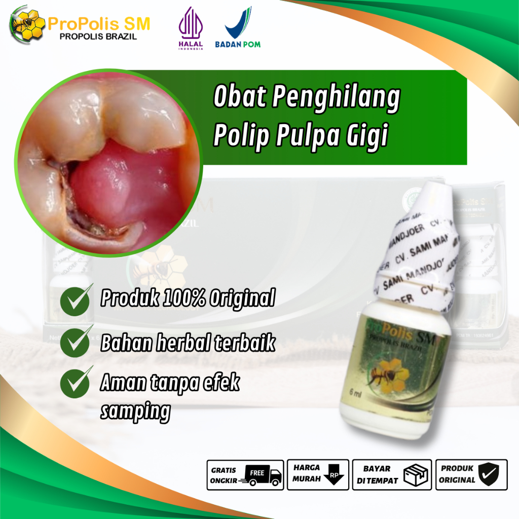 Jual Obat Tetes Polip Gigi Pengempis Polip Pulpa Gigi Penghilang