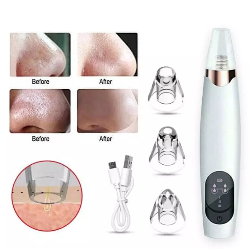 Alat Penyedot Komedo dan Jerawat / Vacum Pembersih Komedo Wajah Blackhead Remove MURAH | AutoStock