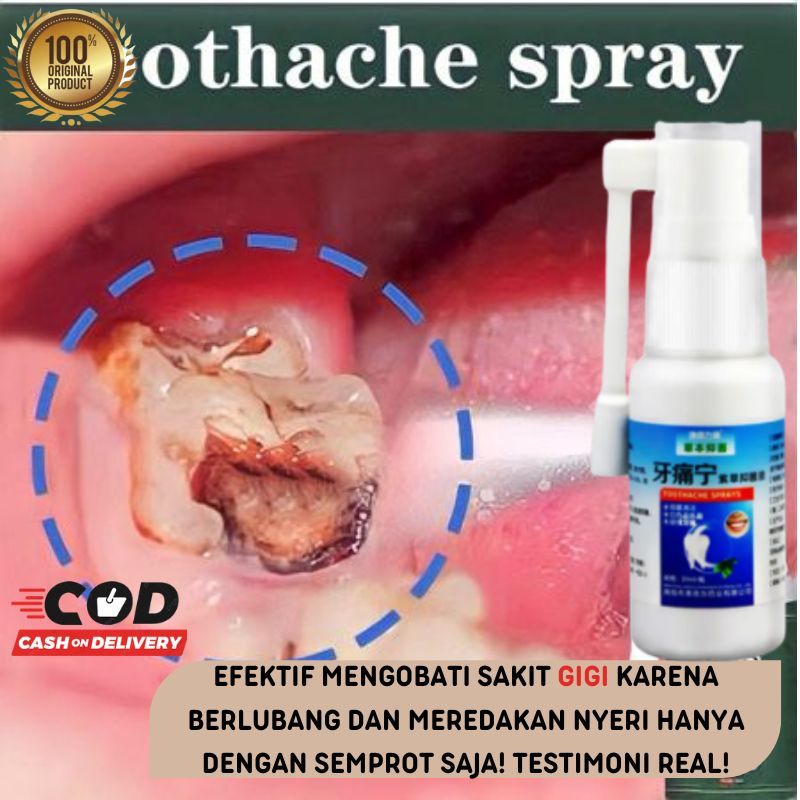 Jual Obat Sakit Gigi Semprot Berlubang Gusi Bengkak Spray Sakit Gigi Shopee Indonesia 9017