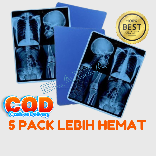 Jual Medical Dry Film Digital Radiology DR CR Rontgen X-Ray Inkjet Blue ...
