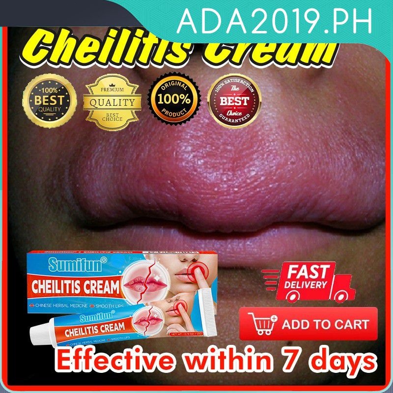 Jual Krim pelembab bibir pelembab bibir hitam Cheilitis cream Angular Cheilitis kulit pada area