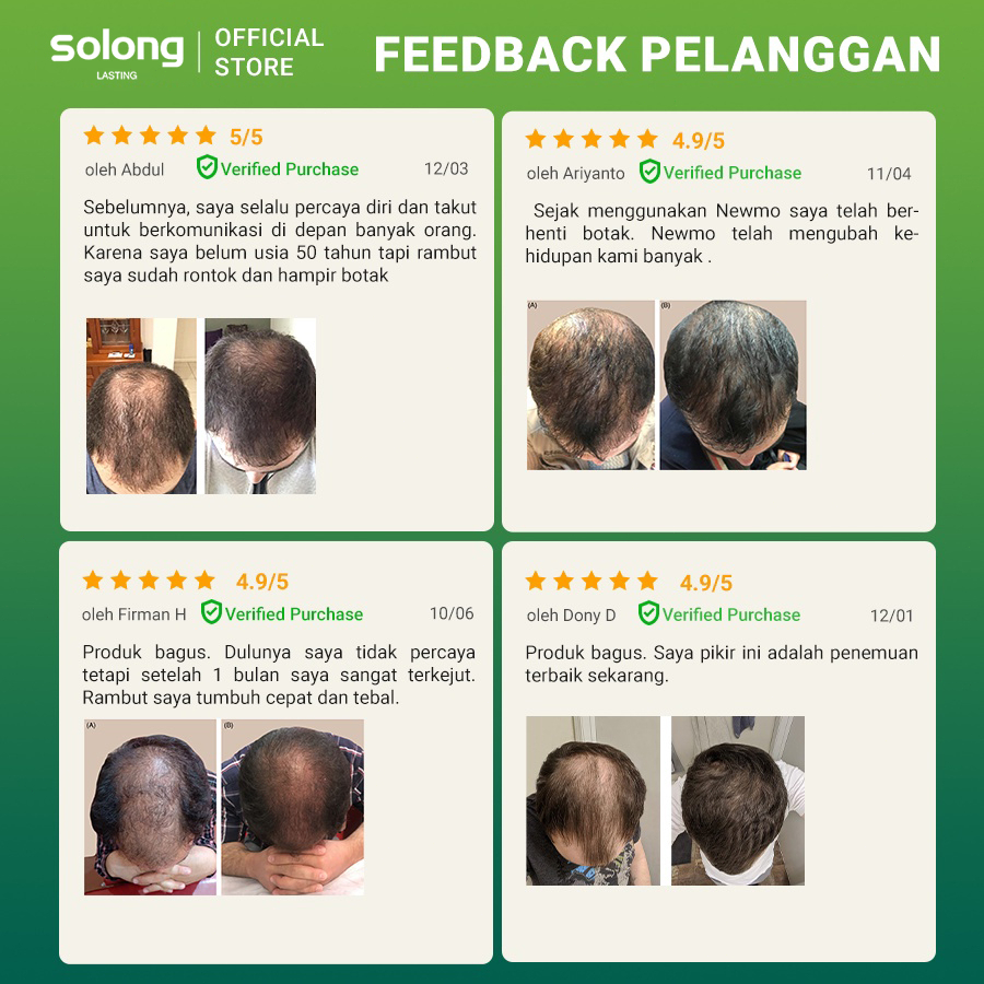 Jual Obat penumbuh rambut Hair growth serum Minyak Spray Penumbuh ...