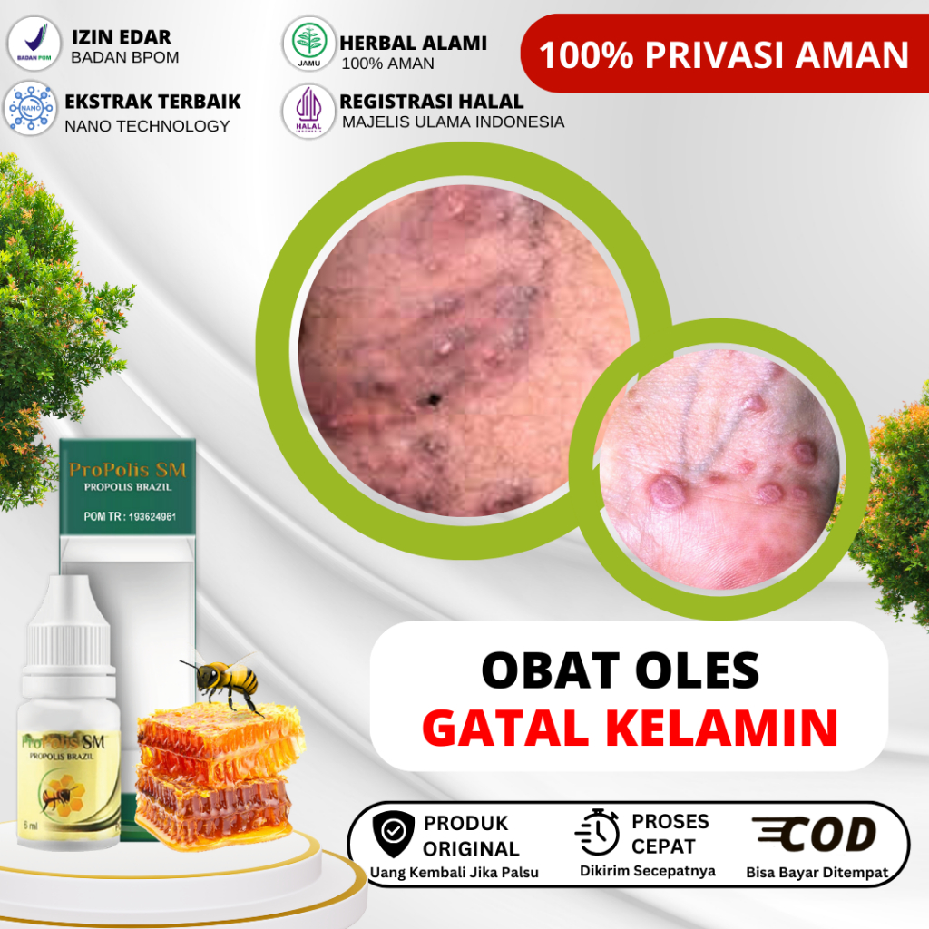 Jual Obat Budug Obat Gatal Kelamin Obat Gatal Selangkangan Gatal Buah