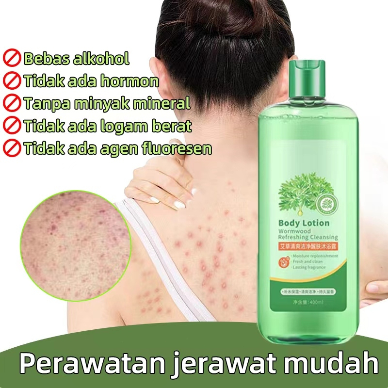 Jual Sabun jerawat punggung ance Body wash whitening sabun jerawat
