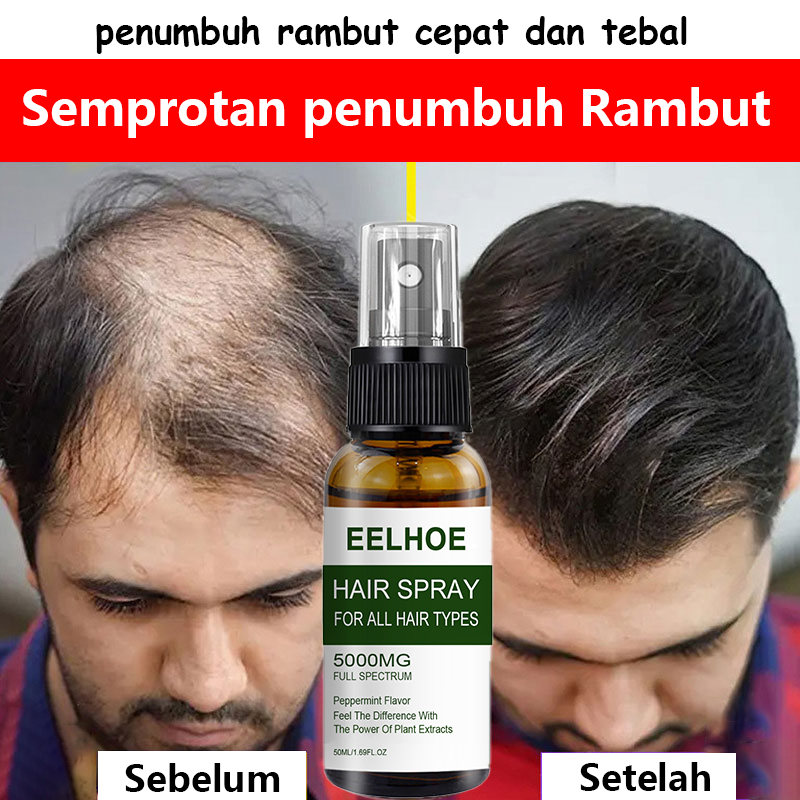 Jual Penumbuh Rambut Botak Semprotan Penumbuh Rambut Obat Rambut Botak ...