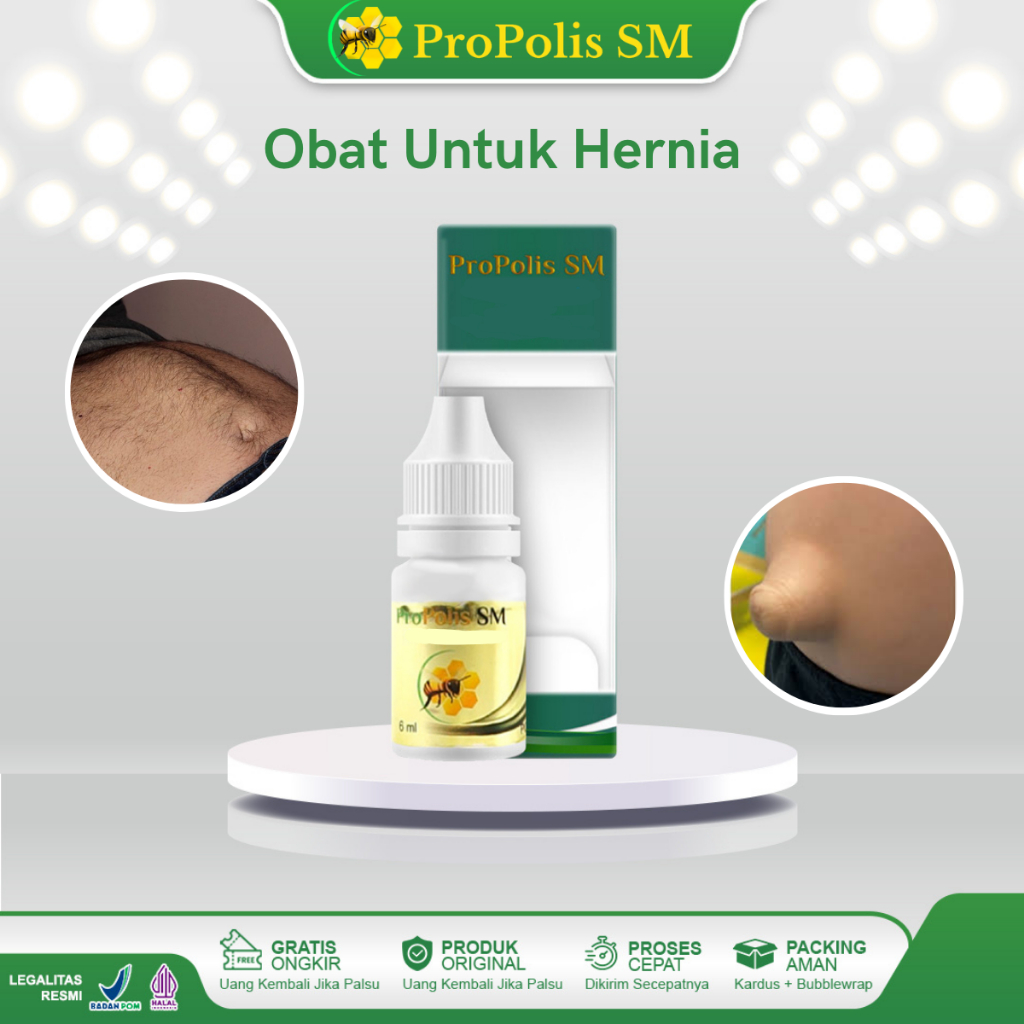 Jual Obat Hernia, Obat Hernia Turun Berok Bayi Anak Dan Dewasa, Hernia