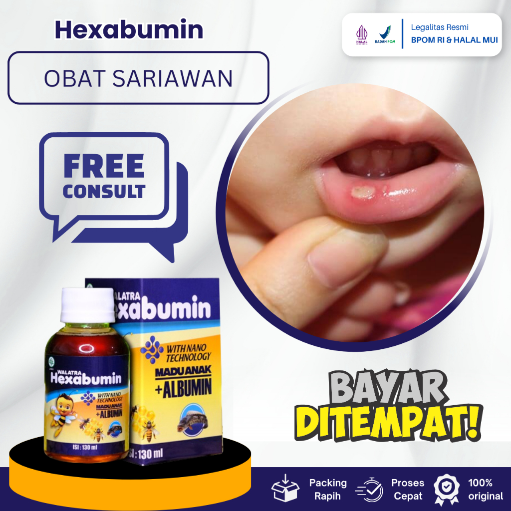 Jual Obat Sariawan Di Lidah Dan Di Bibir Anak, Obat Luka Sariawan Anak ...
