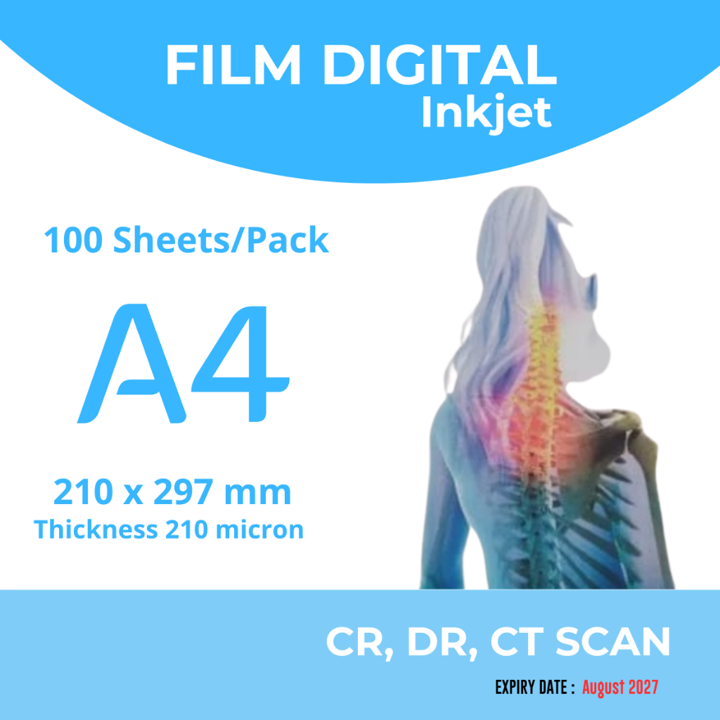 Jual Medical Imaging Radiologi Rontgen X-Ray Dry Film Digital Inkjet ...