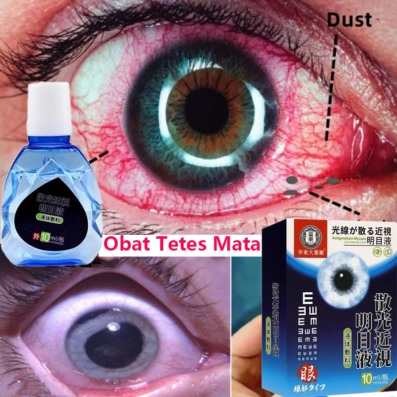 Jual Obat Tetes Mata Obat Mata Katarak Eye Drop Obat Mata Buram Obat ...