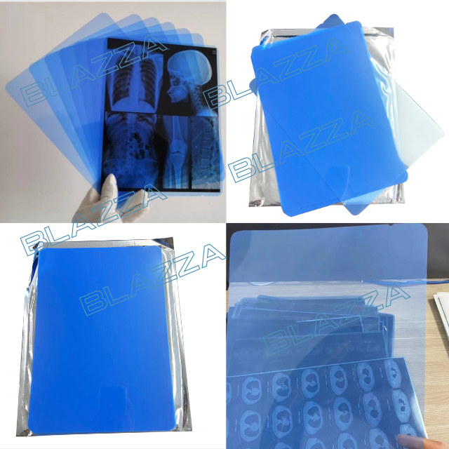 Jual Paper Medical Dry Film Digital MCU Radiology DR CR Rontgen X-Ray ...