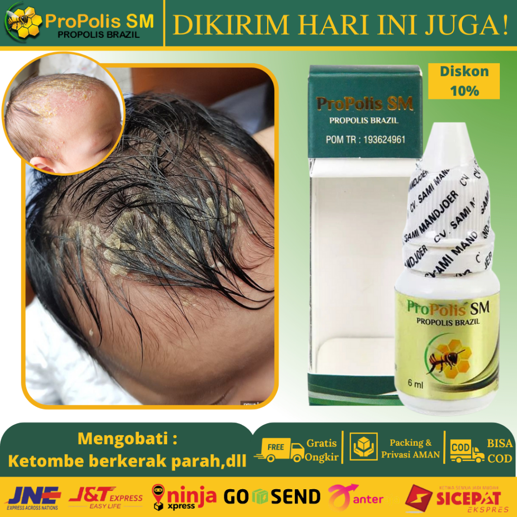 Jual Obat Rambut Rontok Apotik Terlengkap & Harga Terbaru Juni 2026 ...