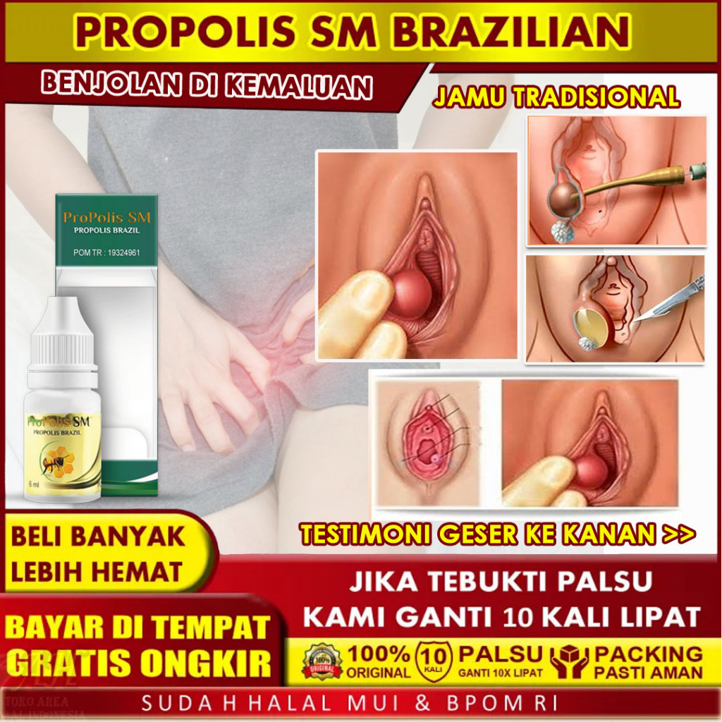 Jual Obat Tetes Penghilang Benjolan Di Miss v, Benjolan Bernanah, Bisul,  Kista Bartholin, Benjolan di Bibir Vagina, Kutil kelamin, Herpes Genital,  Keputihan Abnormal, Vagina Gatal Dan Bau, Varises vagina, Kanker vulva,  Kanker