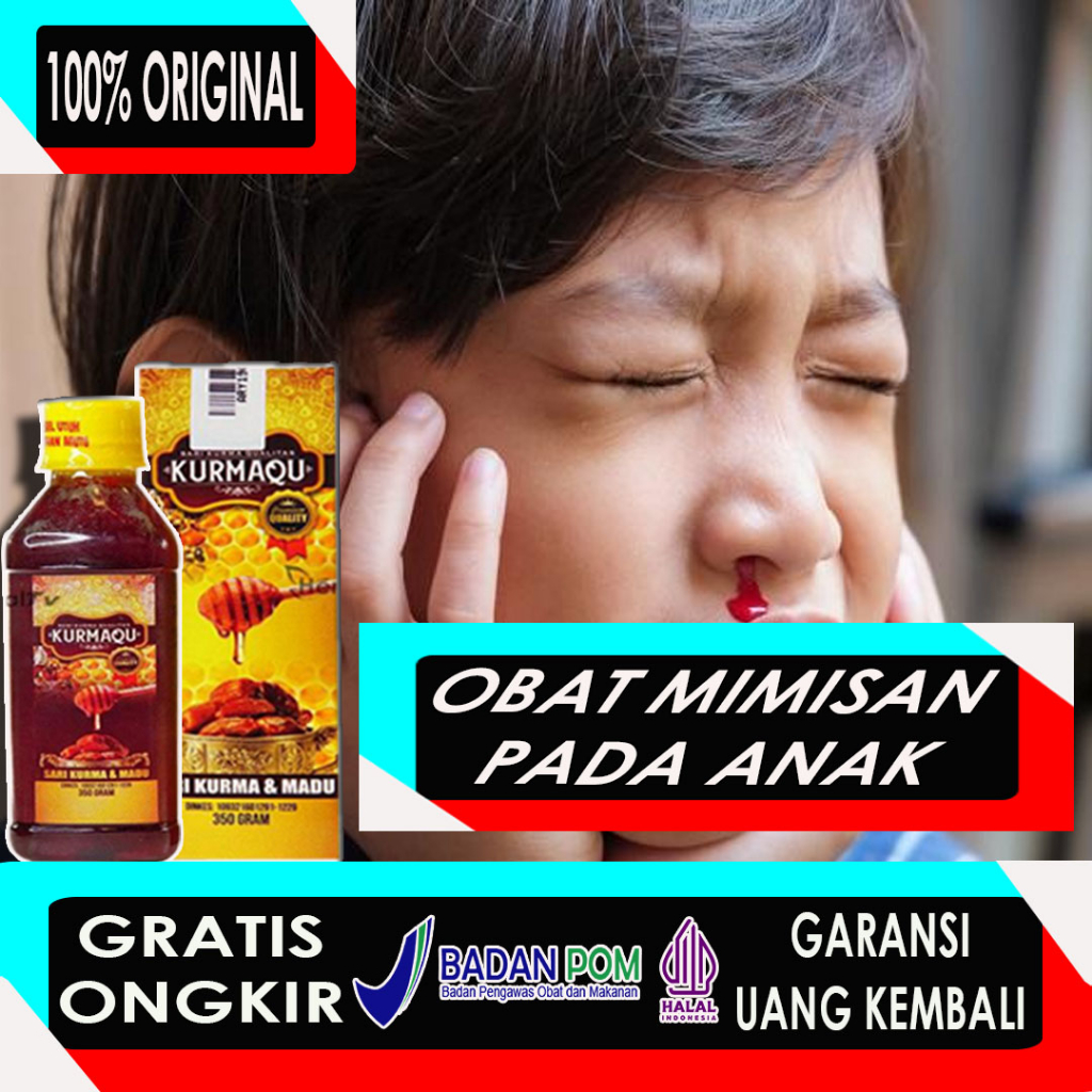 Jual Madu KurmaQu Obat Mimisan Anak Obat Mimisan Hidung Mengatasi Mimisan Di Sertai Sakit