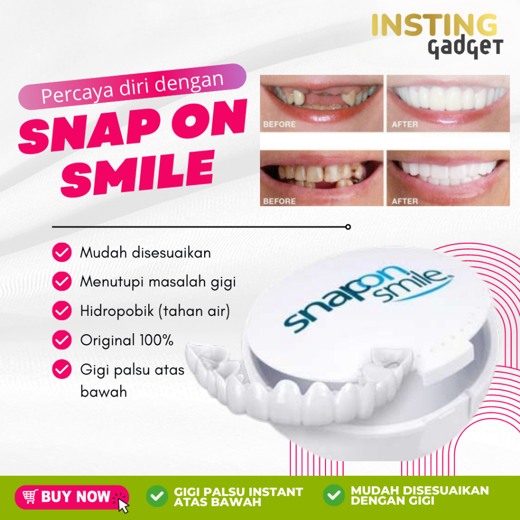 Jual Snap On Smile 100% Original Authentic Gigi Palsu 1 Set Atas Bawah ...