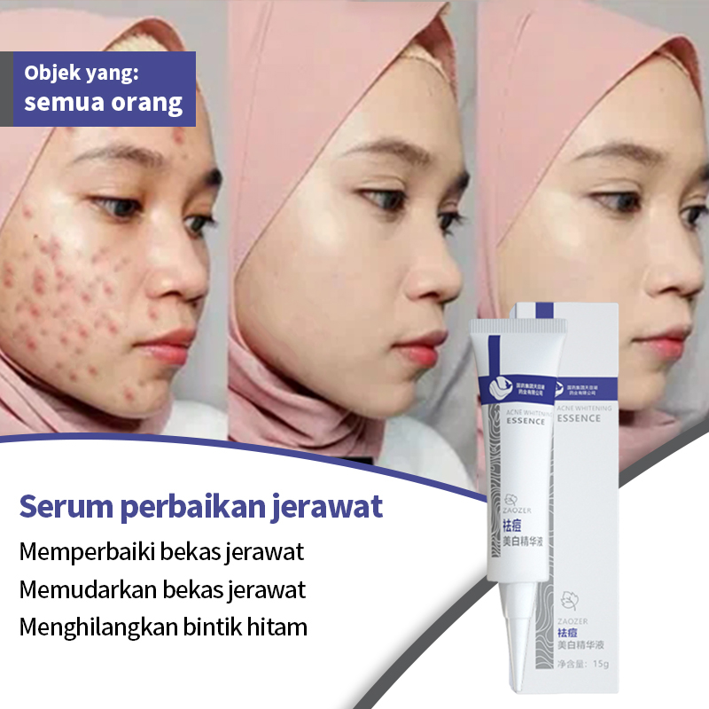 Jual Obat jerawat dan bekas jerawat penghilang bekas jerawat salep