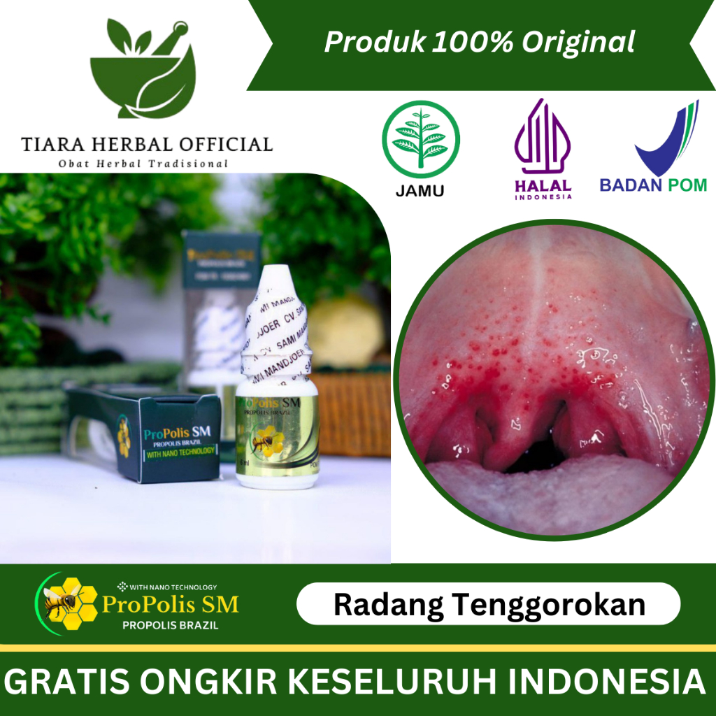 Jual Obat Tenggorokan Kering Dan Sakit, Herbal Nyeri Tenggorokan, Obat ...