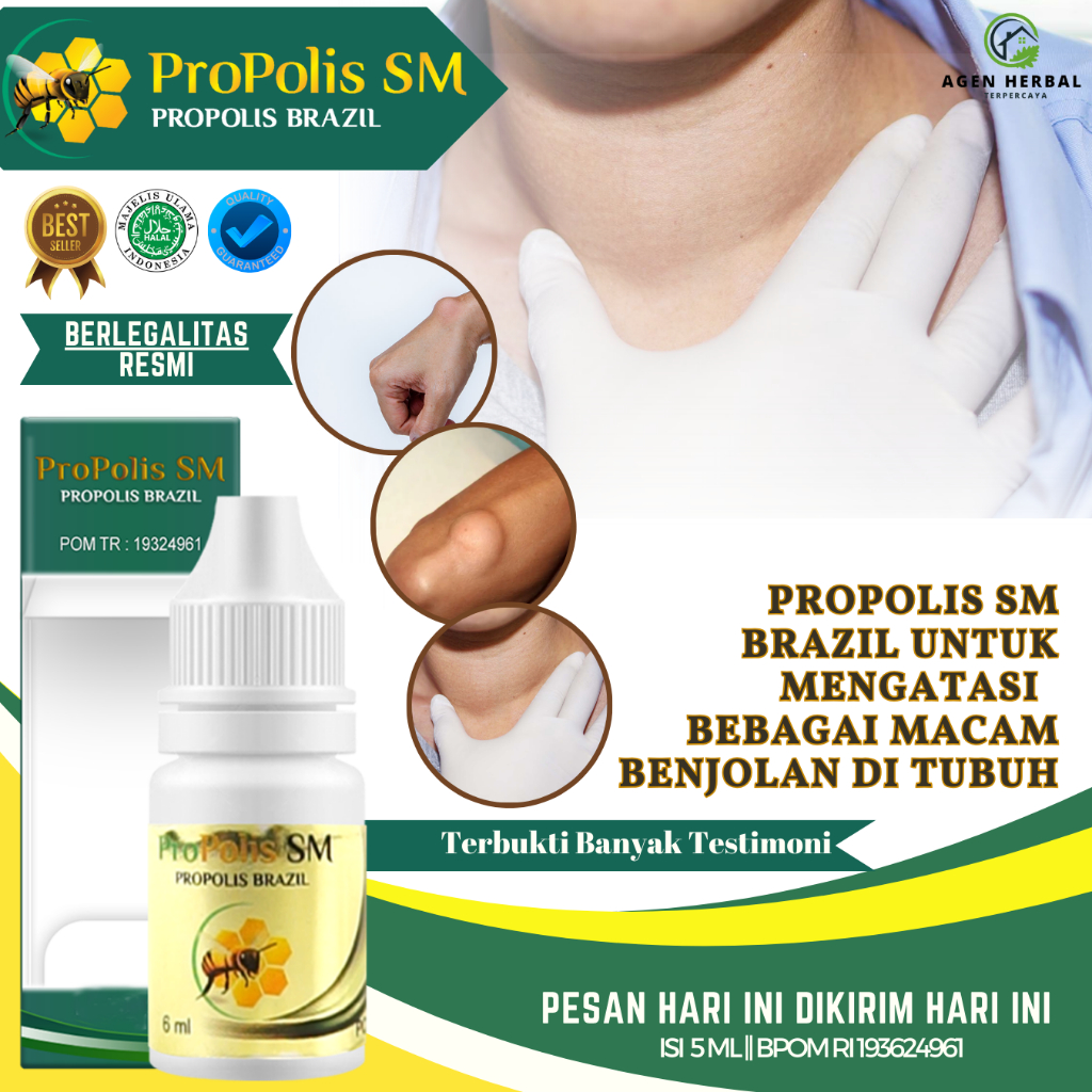 Jual Obat Benjolan Lipoma Obat Oles Benjolan Penghancur Benjola Kelenjar Getah Bening 0644