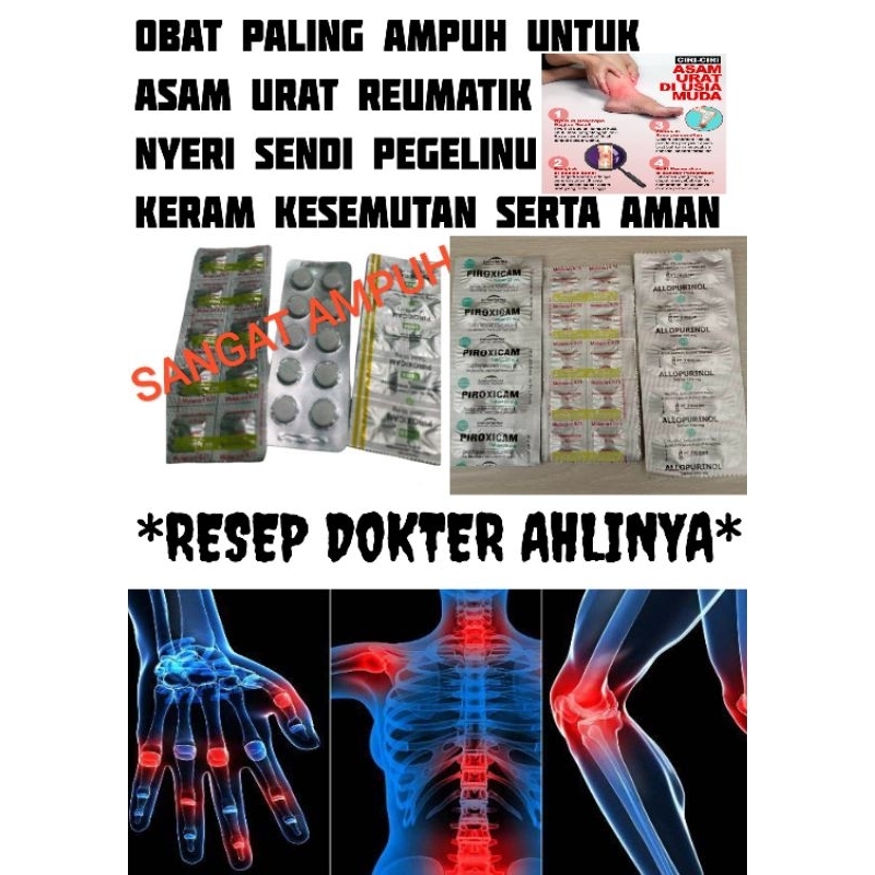 Jual Obat Asam Urat Reumatik Nyeri Sendi Pegelinu Kram Kesemutan Pada Kaki Dan Tangan Bpom