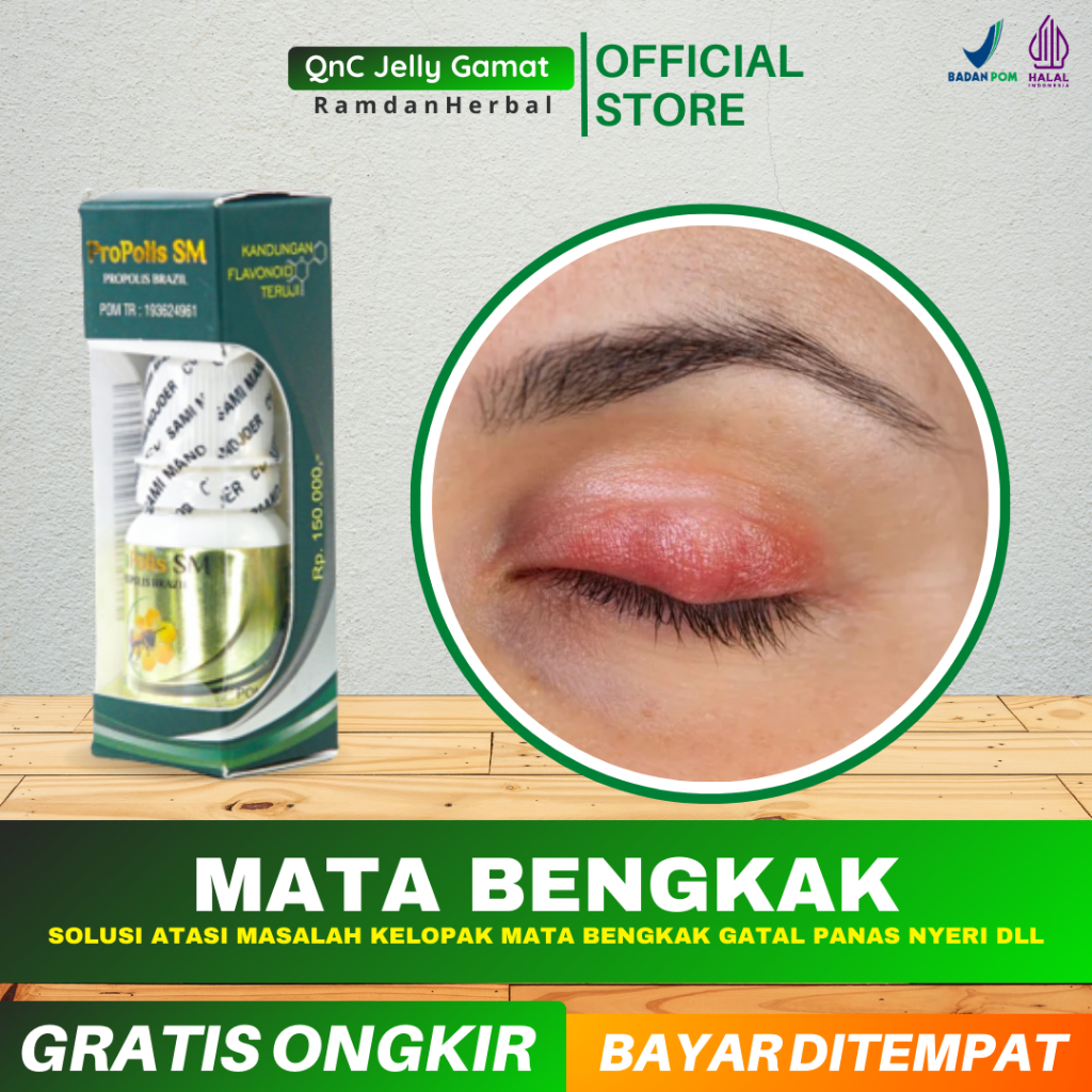 Jual Obat Mata Bengkak Gatal Panas Salep Oles Mata Bengkak Bisul ...