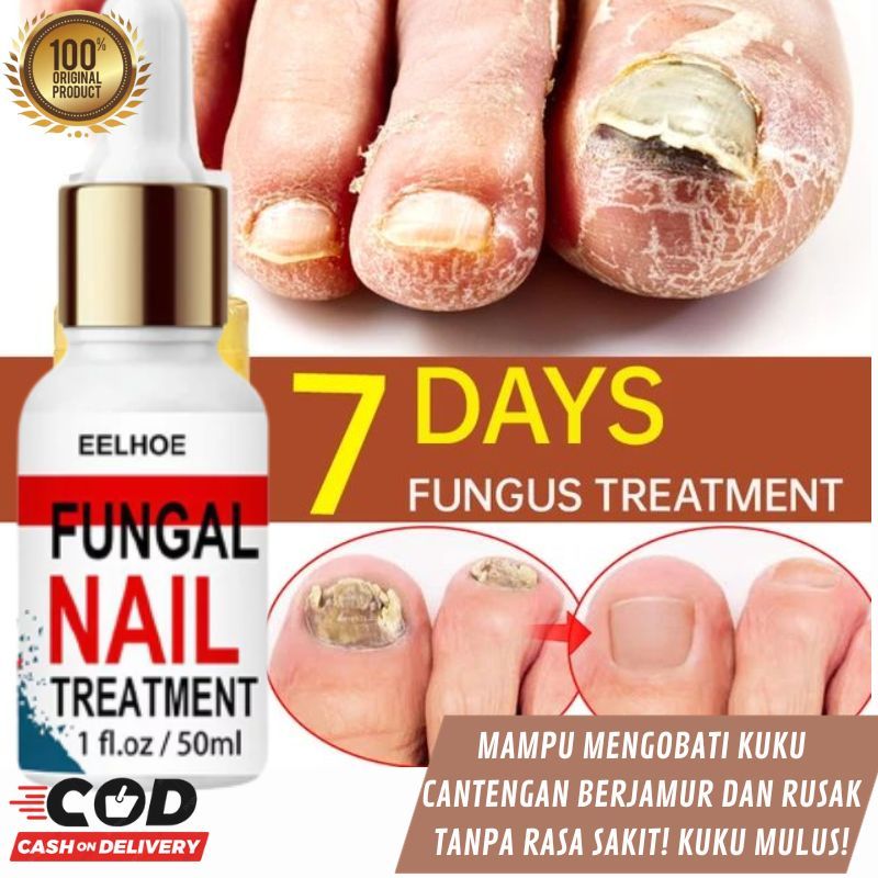 Jual Nail Repair Essence Serum Kuku jamur dan rusak dan cantengan