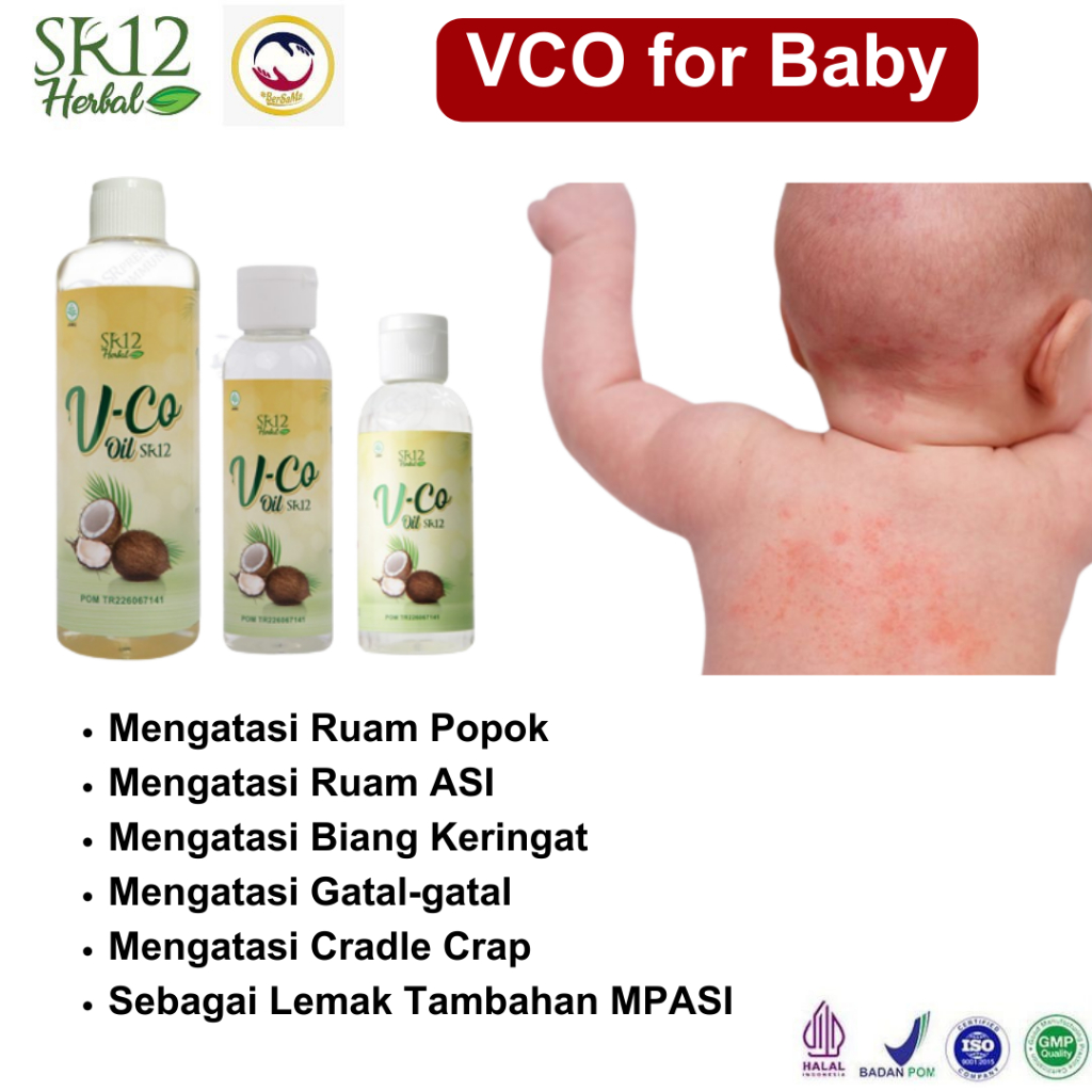 Jual Obat Ampuh Iritasi Pada Punggung Bayi Gatal Merah di Leher Ruam