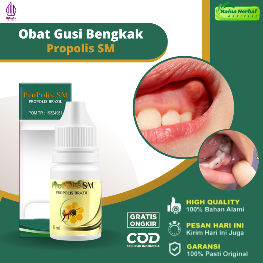 Jual Obat Gusi Bengkak Sakit Gigi Berlubang Radang Gusi Abses Gusi Gusi ...