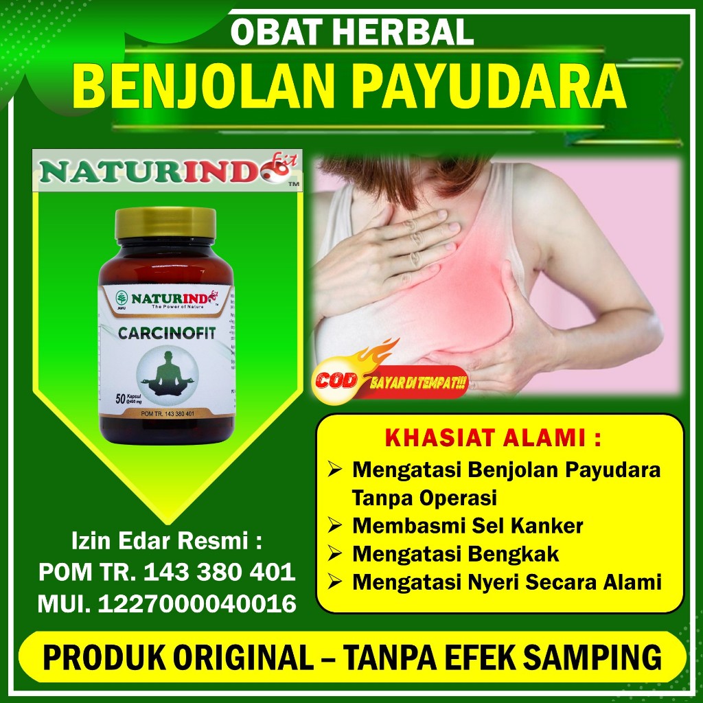 Jual Obat Benjolan Payudara Fam Mastitis Bengkak Herbal Carcinofit Shopee Indonesia