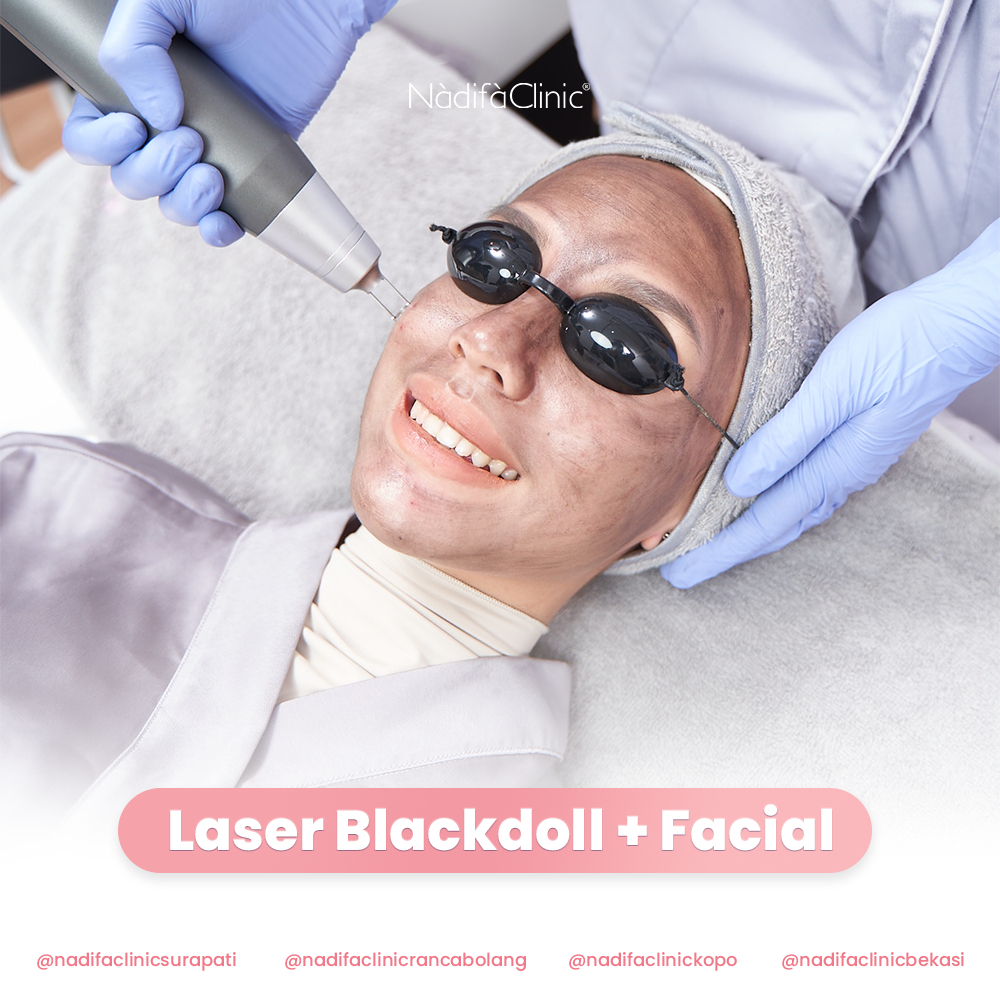Jual Laser Blackdoll + facial | Shopee Indonesia