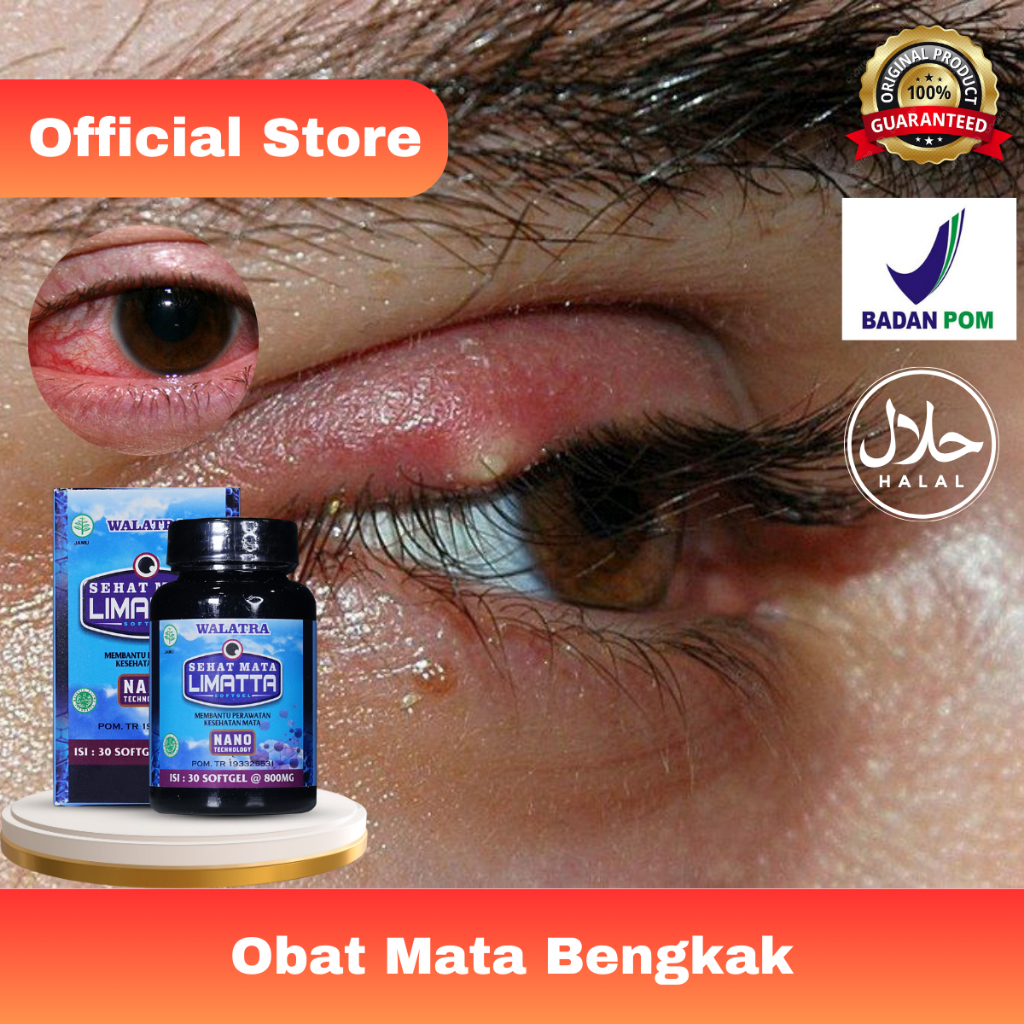 Jual Obat Mata Bengkak, Mata Silinder, Pandangan Kabur, Rabun Jauh ...