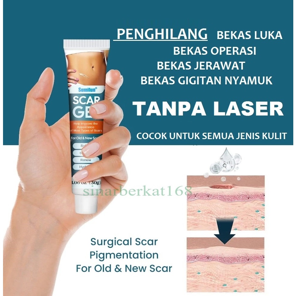Jual GEL penghilang bekas jerawat / luka / operasi / gigitan nyamuk ...