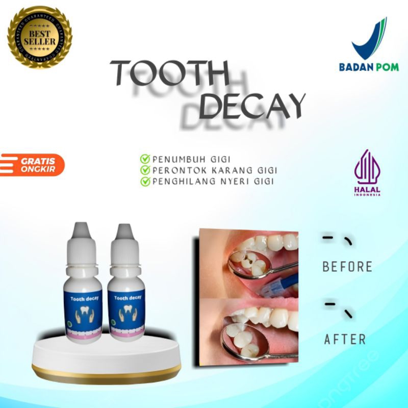 Jual Tooth Decay penumbuh gigi penghilang nyeri gigi perontok karang