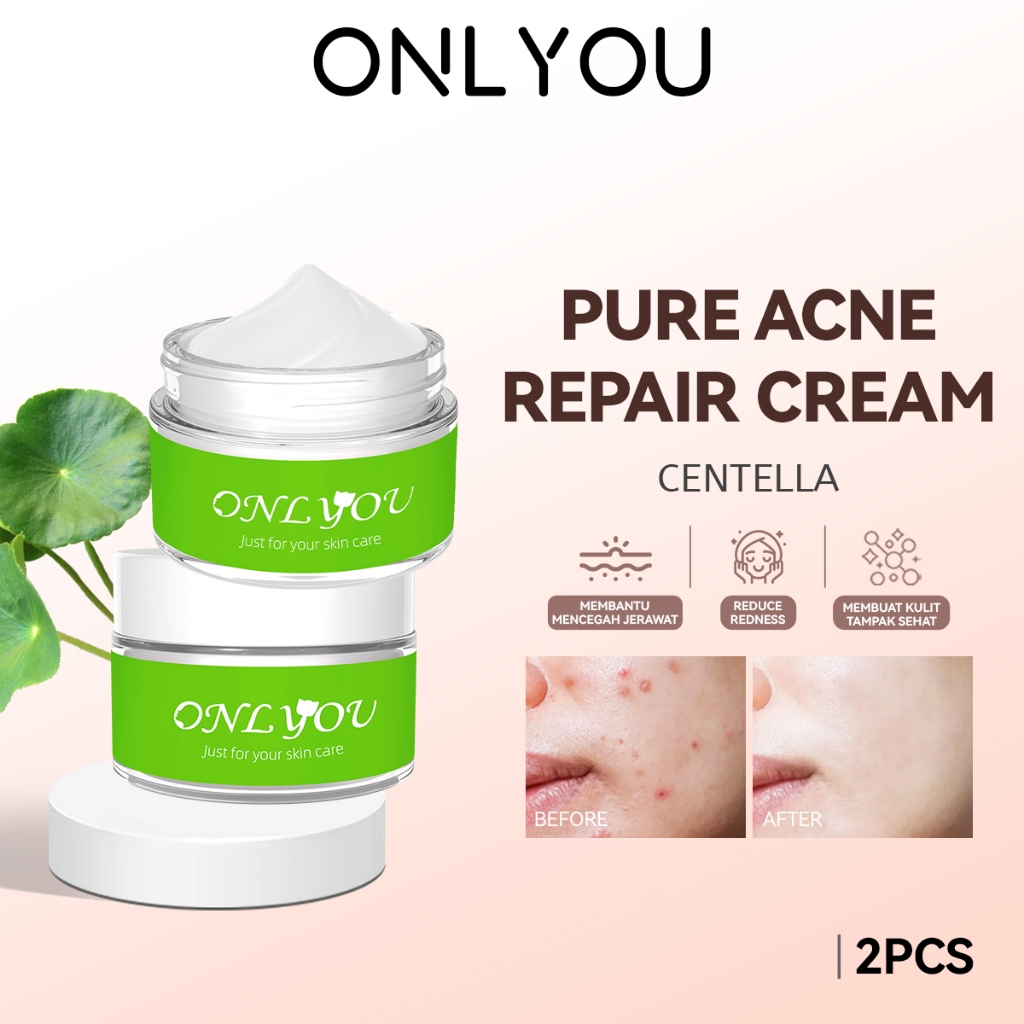 Jual ONLYOU Pure Acne Repair Cream Totol Jerawat -Centella Soothing ...