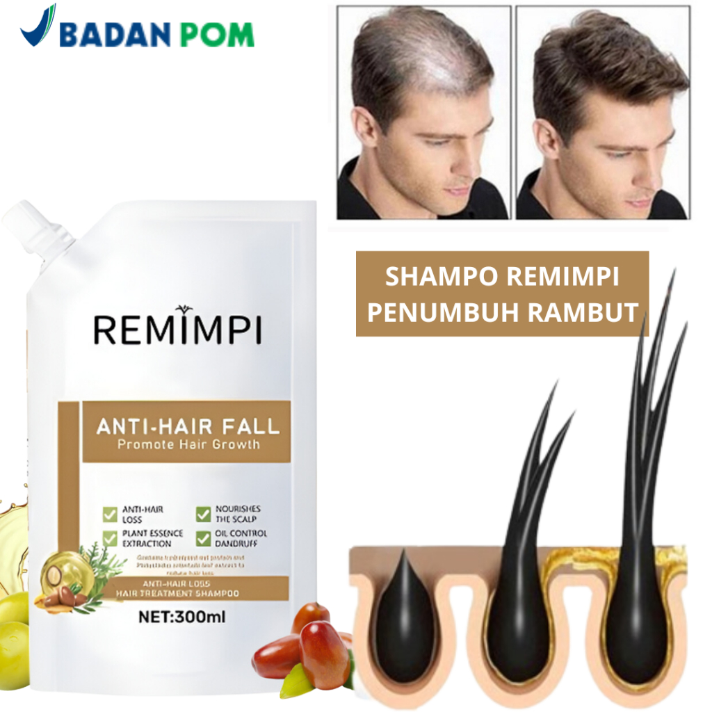 Jual Remimpi Official - Anti Hair Fall Hair Treatment Shampoo Oil ...