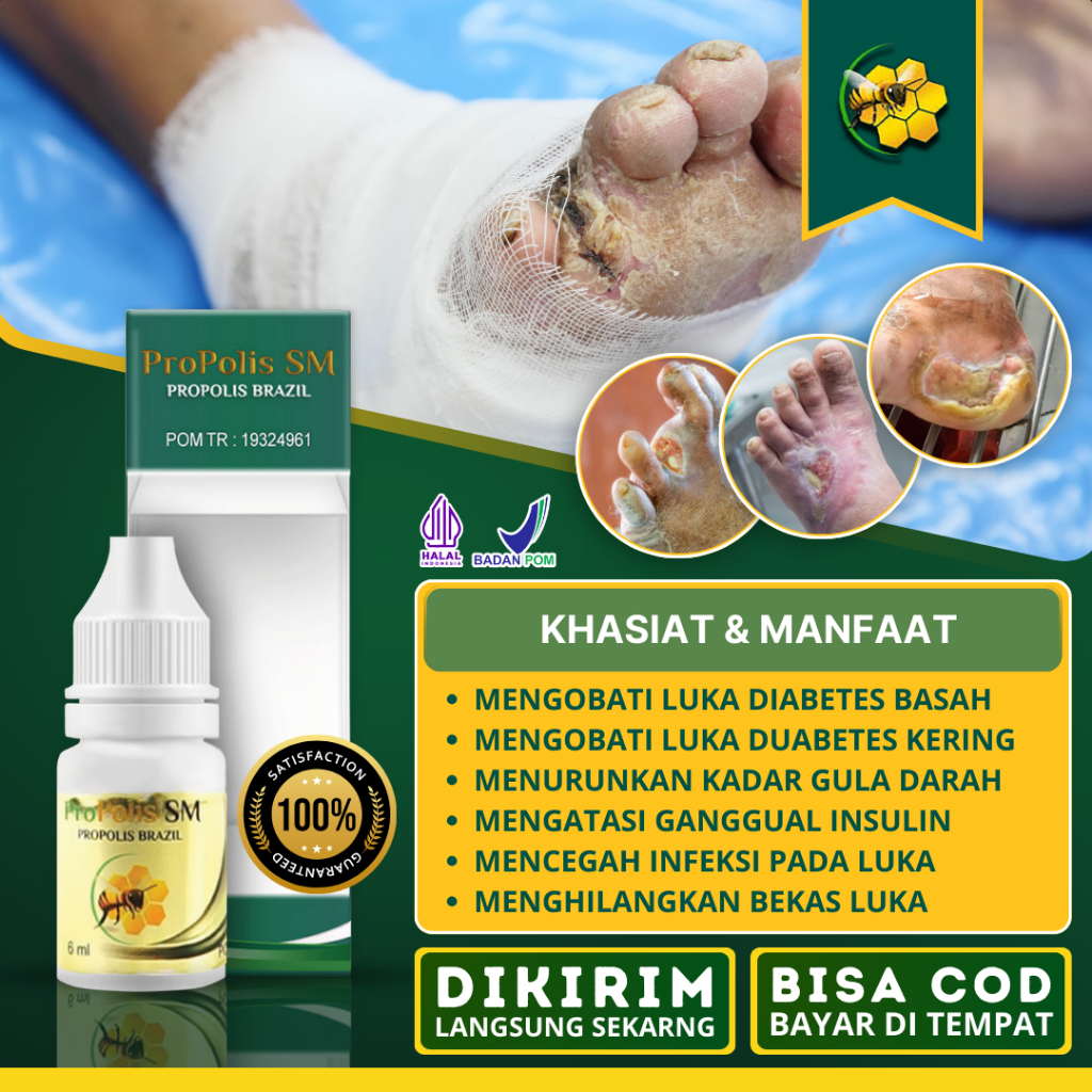 Jual Obat Diabetes Basah dan Kering, Obat Pengering Luka Diabetes Gula ...